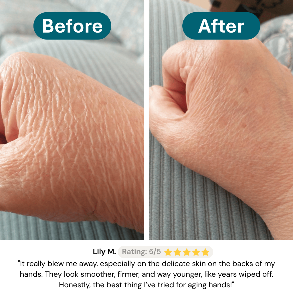 Rovelle Crepey Skin Repair Treatment