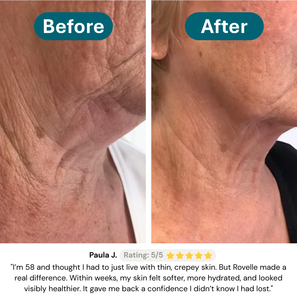 Rovelle Crepey Skin Repair Treatment