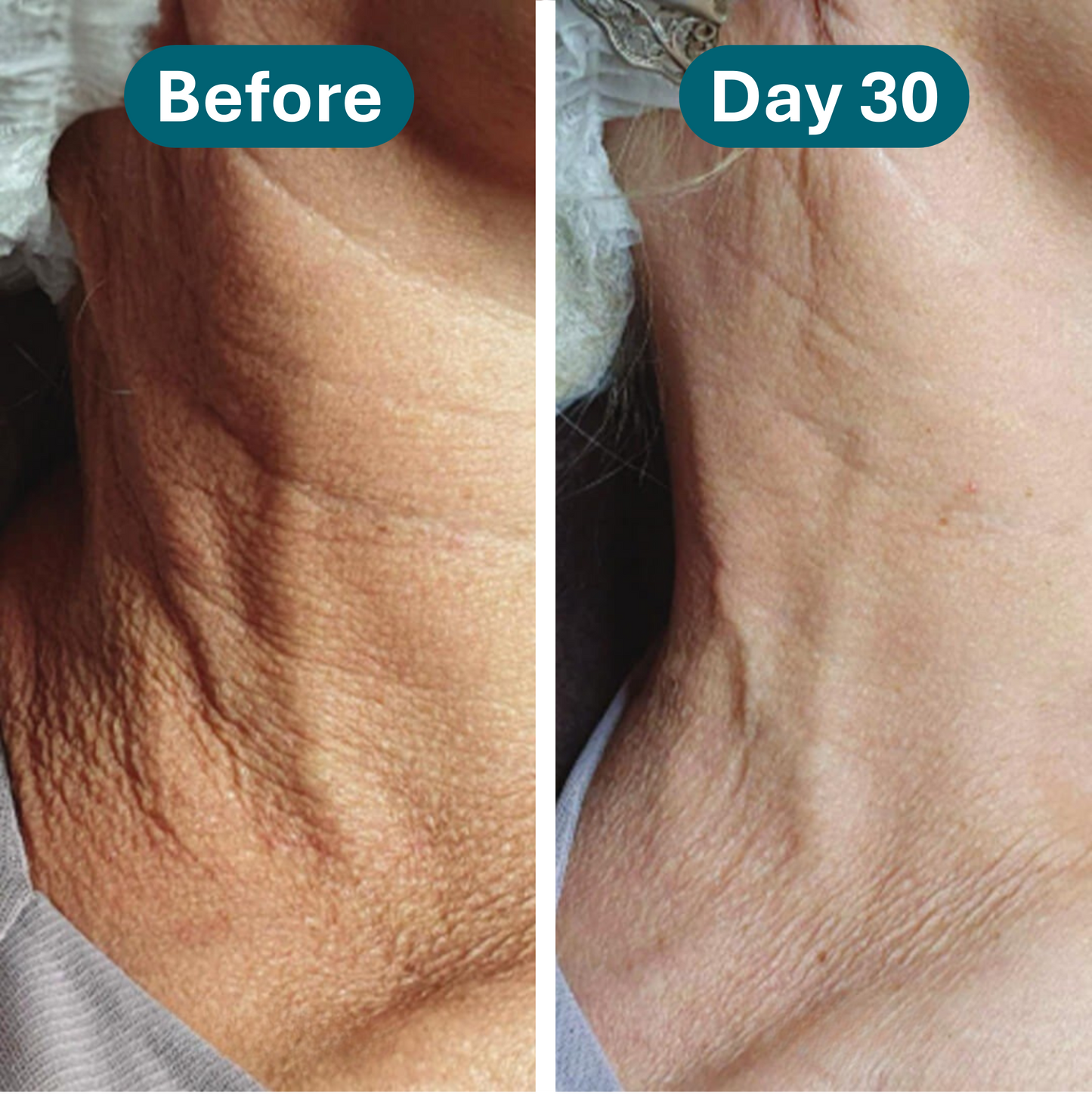 Rovelle Crepey Skin Repair Treatment