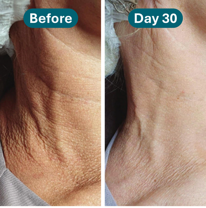 Rovelle Crepey Skin Repair Treatment