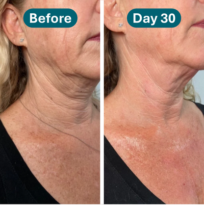 Rovelle Crepey Skin Repair Treatment